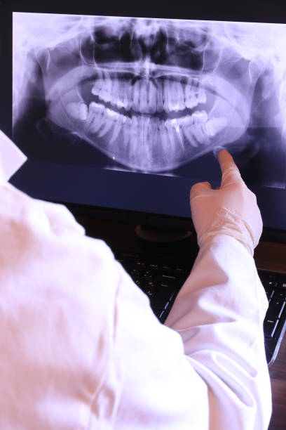 Best Emergency Tooth Extraction in Butler, OH