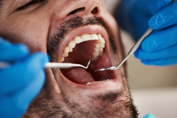 Best Walk-In Emergency Dentist in Butler, OH